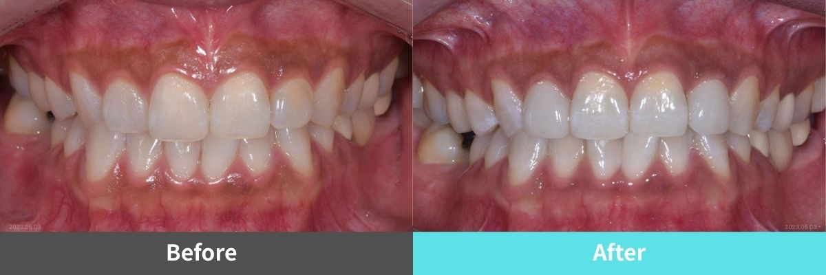 #image_title #separator_sa KOREA NEW N DENTAL CLINIC