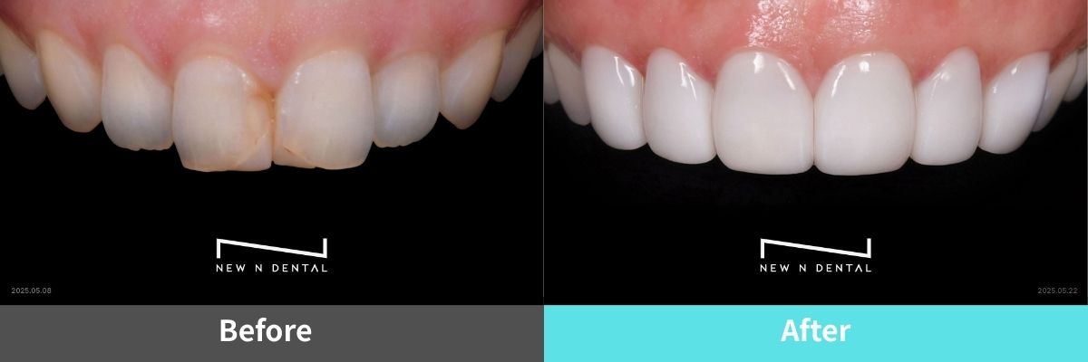 #image_title #separator_sa KOREA NEW N DENTAL CLINIC