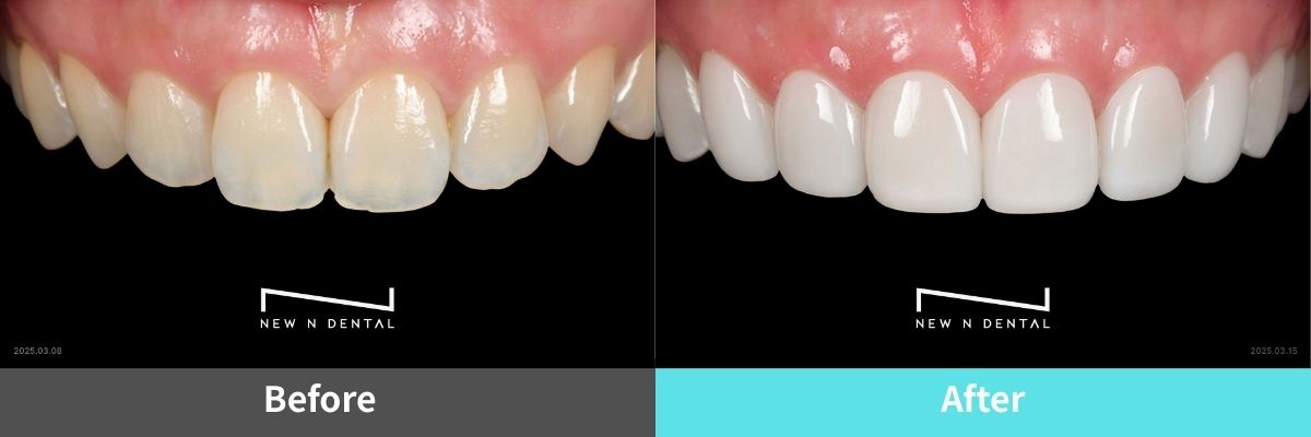 #image_title #separator_sa KOREA NEW N DENTAL CLINIC