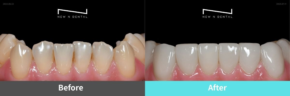 #image_title #separator_sa KOREA NEW N DENTAL CLINIC