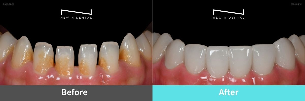 #image_title #separator_sa KOREA NEW N DENTAL CLINIC