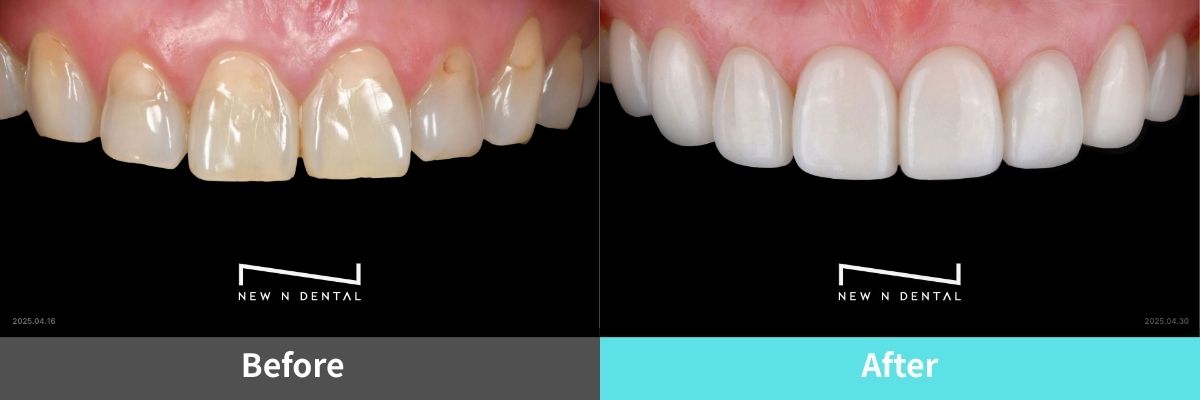 #image_title #separator_sa KOREA NEW N DENTAL CLINIC