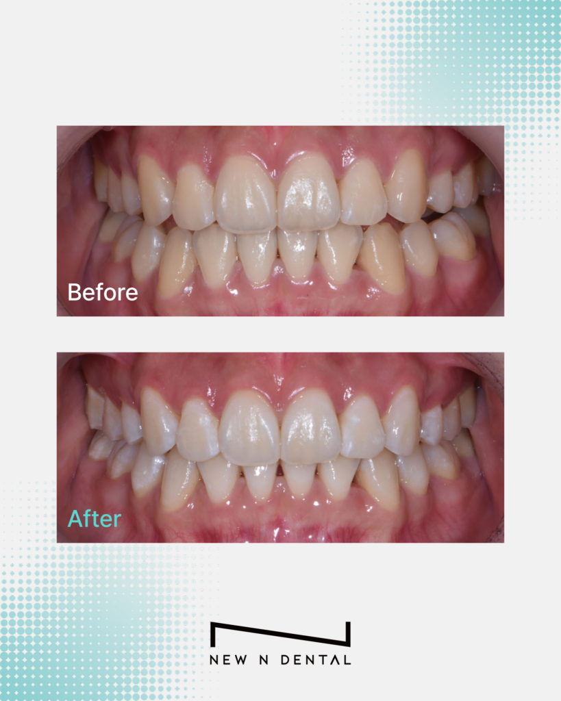  • KOREA NEW N DENTAL CLINIC