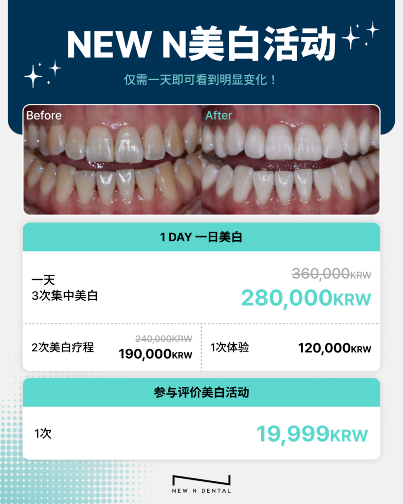 日牙齿美白活动价格指南 • Dental Clinic for English Speakers in Korea • KOREA NEW N DENTAL CLINIC